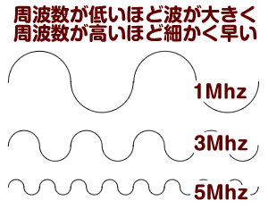 超音波のイメージ図
